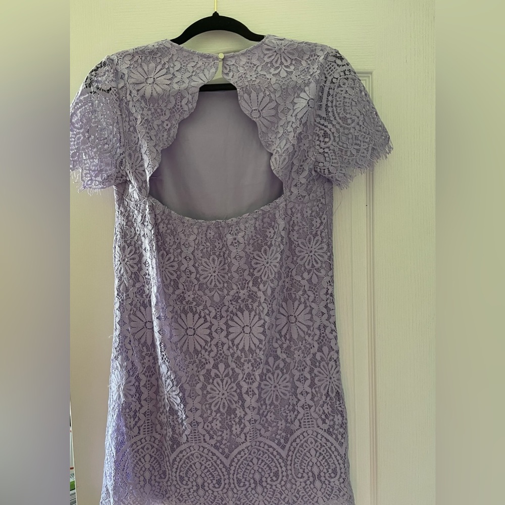 NWT Francescas lace dress size small - Picture 2 of 5